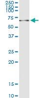 Anti-HEXA Polyclonal Antibody Pair