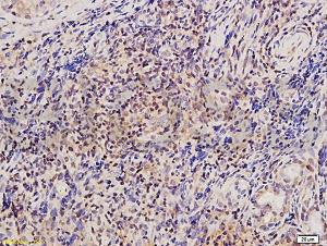 Anti-TWIST Rabbit Polyclonal Antibody