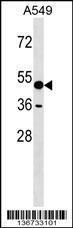 Anti-AMY1A Rabbit Polyclonal Antibody (AP (Alkaline Phosphatase))