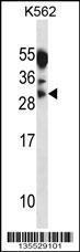 Anti-MYOG Rabbit Polyclonal Antibody (FITC (Fluorescein Isothiocyanate))