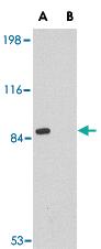 Anti-RIMS2 Rabbit Polyclonal Antibody