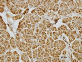 Anti-CENPJ Mouse Monoclonal Antibody [clone: 5D5]