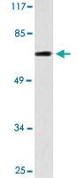 Anti-SCNN1D Rabbit Polyclonal Antibody