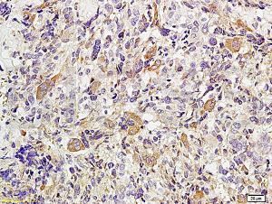 Anti-TWIST Rabbit Polyclonal Antibody