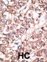 Anti-Dkk-2 Rabbit Polyclonal Antibody (Biotin)