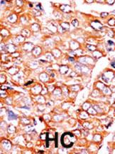 Anti-BID Rabbit Polyclonal Antibody