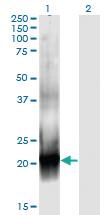 Anti-RAC2 Mouse Monoclonal Antibody [clone: 3B8]