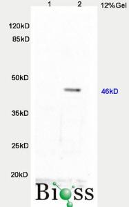 Anti-TWIST Rabbit Polyclonal Antibody