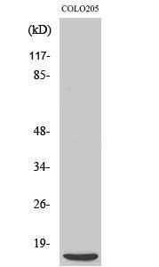 Western blot analysis of various cells using Anti-4E-BP1 Antibody