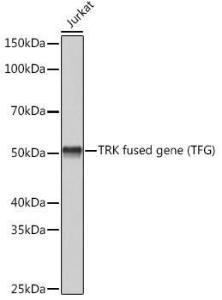 Western blot analysis of extracts of Jurkat cells, using Anti-TRK fused gene Antibody [ARC1882] (A305376) at 1:3,000 dilution