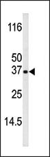 Anti-BIK Rabbit Polyclonal Antibody