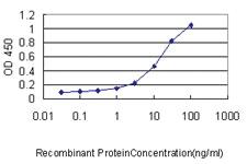 Anti-GFI1 Mouse Monoclonal Antibody [clone: 3G8]