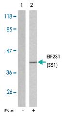 Anti-EIF2S1 Rabbit Polyclonal Antibody