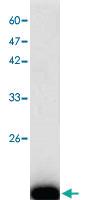 Anti-Dengue virus E-D3 Mouse Monoclonal Antibody [clone: 5j122]