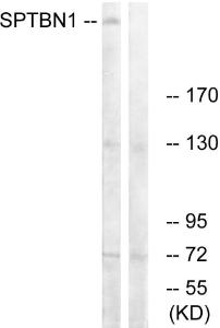 Western blot analysis of lysates from COLO cells using Anti-SPTBN1 Antibody. The right hand lane represents a negative control, where the antibody is blocked by the immunising peptide