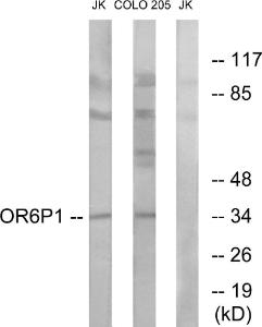 Western blot analysis of lysates from Jurkat and COLO cells using Anti-OR6P1 Antibody. The right hand lane represents a negative control, where the antibody is blocked by the immunising peptide