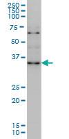 Anti-ZIC4 Mouse Monoclonal Antibody [clone: 3A2]