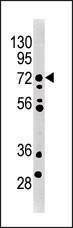 Anti-MELK Rabbit Polyclonal Antibody (HRP (Horseradish Peroxidase))