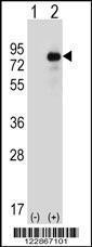 Anti-HIPK4 Rabbit Polyclonal Antibody (APC (Allophycocyanin))