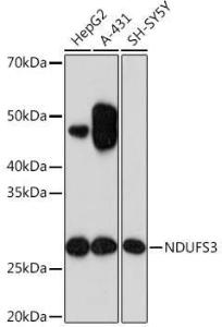 Western blot analysis of extracts of various cell lines, using Anti-NDUFS3 Antibody [ARC1049] (A309182) at 1:1000 dilution