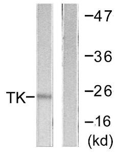 Western blot analysis of lysates from COLO205 cells using Anti-TK Antibody. The right hand lane represents a negative control, where the antibody is blocked by the immunising peptide