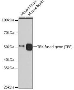 Western blot analysis of extracts of various cell lines, using Anti-TRK fused gene Antibody [ARC1882] (A305376) at 1:3,000 dilution