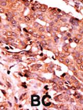 Anti-CASP6 Rabbit Polyclonal Antibody