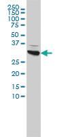 Anti-CBR1 Mouse Monoclonal Antibody [clone: 4D12-1G8]