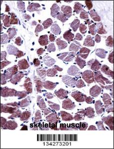 Anti-STEAP1 Rabbit Polyclonal Antibody