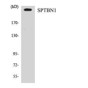 Western blot analysis of the lysates from Jurkat cells using Anti-SPTBN1 Antibody