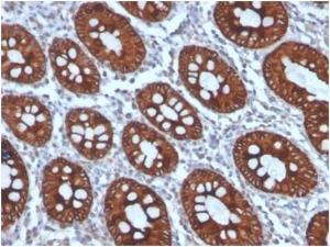 Immunohistochemical analysis of formalin-fixed, paraffin-embedded human colon tissue using Anti-Cytokeratin 8 Antibody [KRT8/4006]