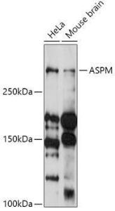 Western blot analysis of extracts of various cell lines, using Anti-ASPM Antibody (A306282) at 1:1,000 dilution The secondary antibody was Goat Anti-Rabbit IgG H&L Antibody (HRP) at 1:10,000 dilution Lysates/proteins were present at 25 µg per lane