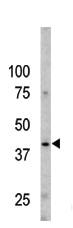 Anti-CASP9 Rabbit Polyclonal Antibody