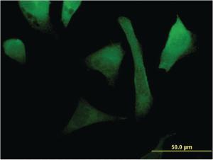 Anti-RAC2 Mouse Monoclonal Antibody [clone: 3B8]