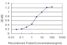 Anti-CENPJ Mouse Monoclonal Antibody [clone: 5D5]