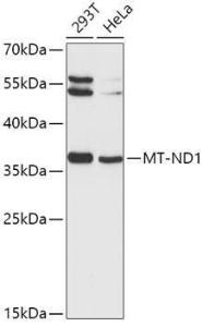 Anti-MT-ND1 antibody