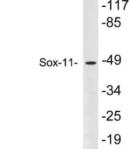 Western blot analysis of lysates from Y79 cells using Anti-Sox-11 Antibody