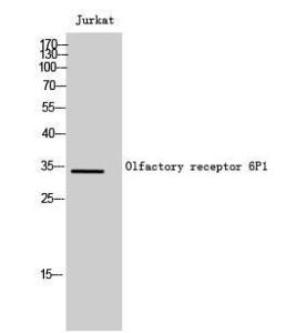 Western blot analysis of Jurkat cells using Anti-OR6P1 Antibody