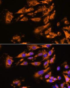 Immunofluorescence analysis of C6 cells using Anti-ASPM Antibody (A306282) at a dilution of 1:100 DAPI was used to stain the cell nuclei (blue)