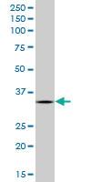 Anti-AIMP1 Mouse Monoclonal Antibody [clone: 3H5]