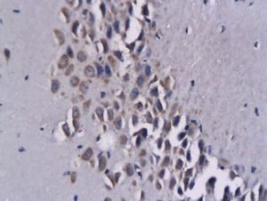 Anti-CCL17 Rabbit Polyclonal Antibody