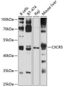 Antibody anti-CXCR5 100 µl