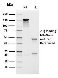 Anti-Prolactin Receptor Mouse Recombinant Antibody [clone: rPRLR/742]