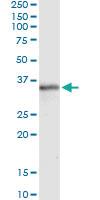 Anti-MSX1 Mouse Monoclonal Antibody [clone: 1E2]