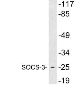 Western blot analysis of lysates from heart tissue using Anti-SOCS-3 Antibody