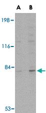 Anti-GPAM Rabbit Polyclonal Antibody