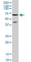 Anti-TAF5L Rabbit Polyclonal Antibody