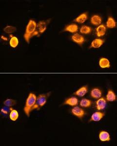 Immunofluorescence analysis of HeLa cells using Anti-ASPM Antibody (A306282) at a dilution of 1:100 DAPI was used to stain the cell nuclei (blue)