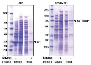 Bacterial Protein Extraction Kits, B-PER™