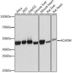 Anti-ACADM/MCAD Rabbit Monoclonal Antibody [clone: ARC1035]